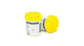 Specimen Jars